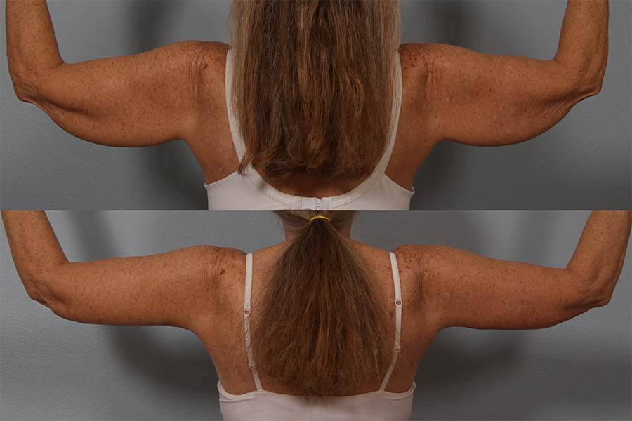 arm-copy